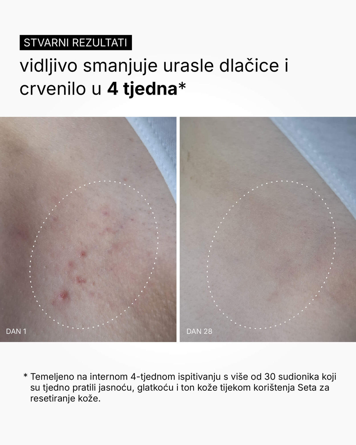 Set za resetiranje kože - rutina za cijelo tijelo