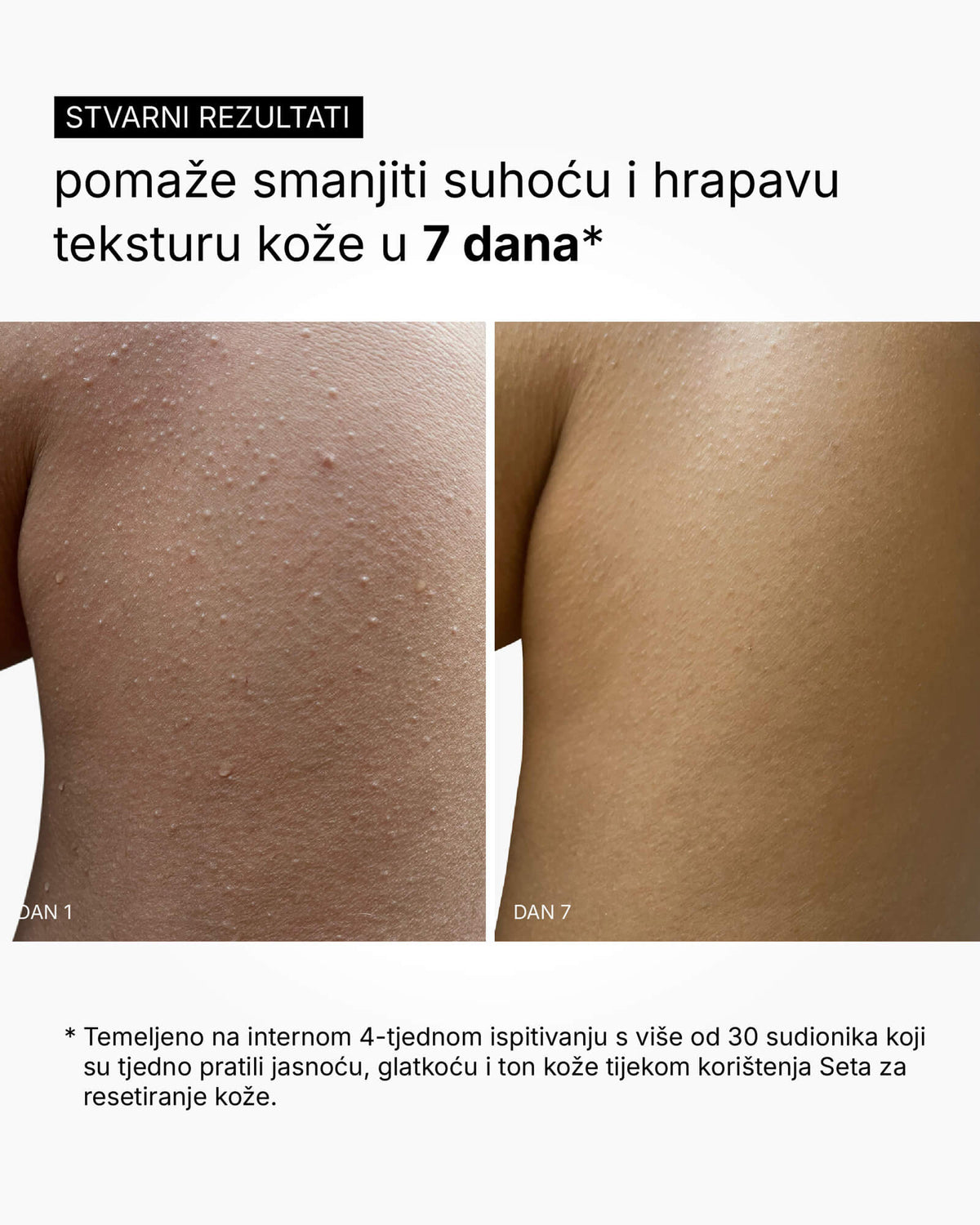 Set za resetiranje kože - rutina za cijelo tijelo