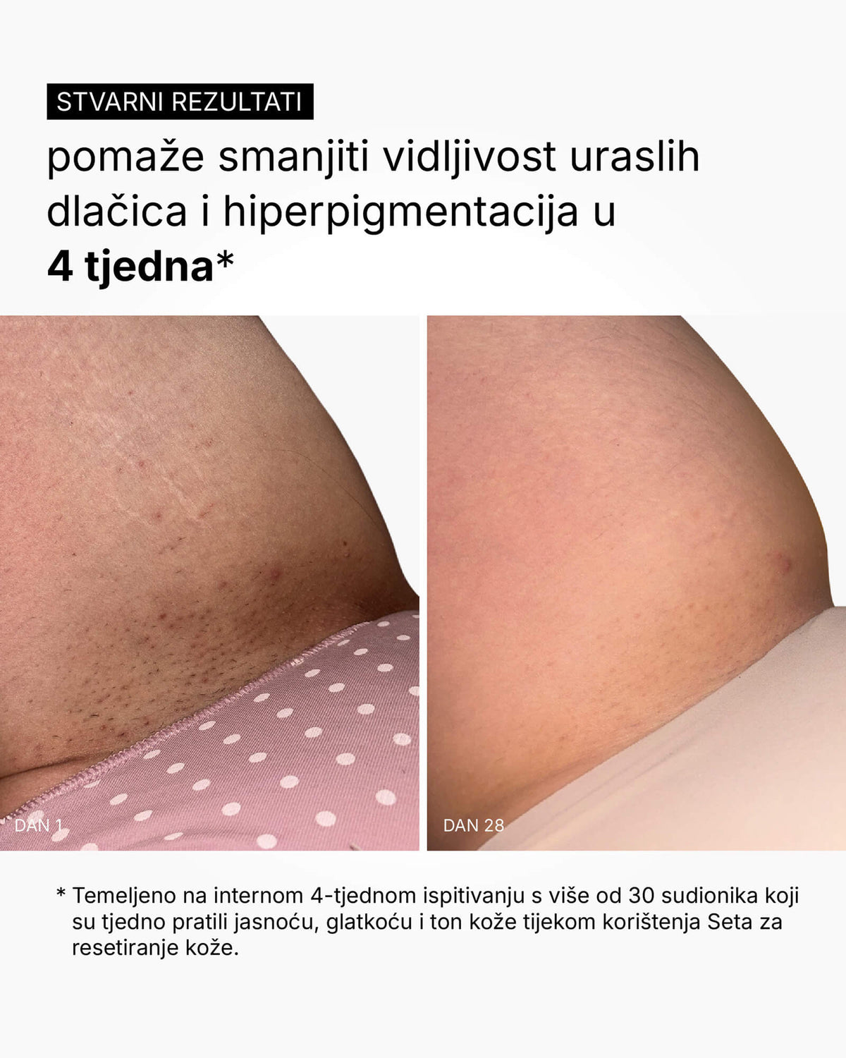 Set za resetiranje kože - rutina za cijelo tijelo