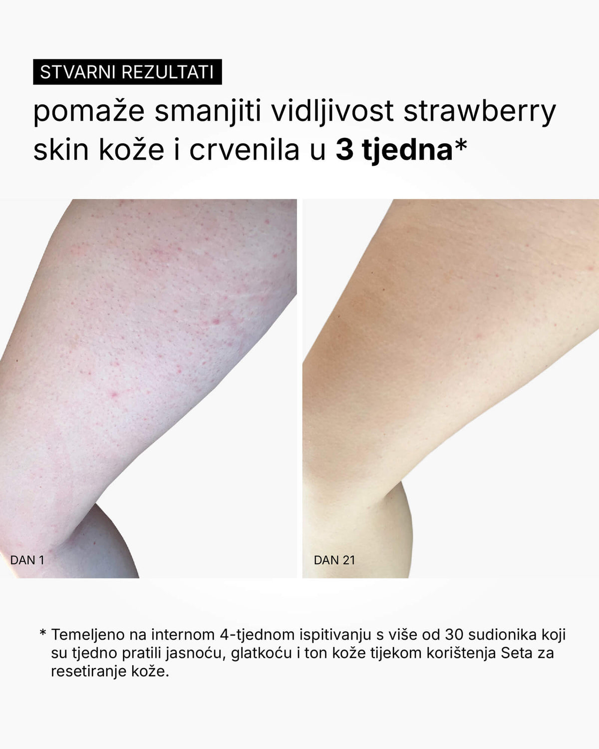 Set za resetiranje kože - rutina za cijelo tijelo