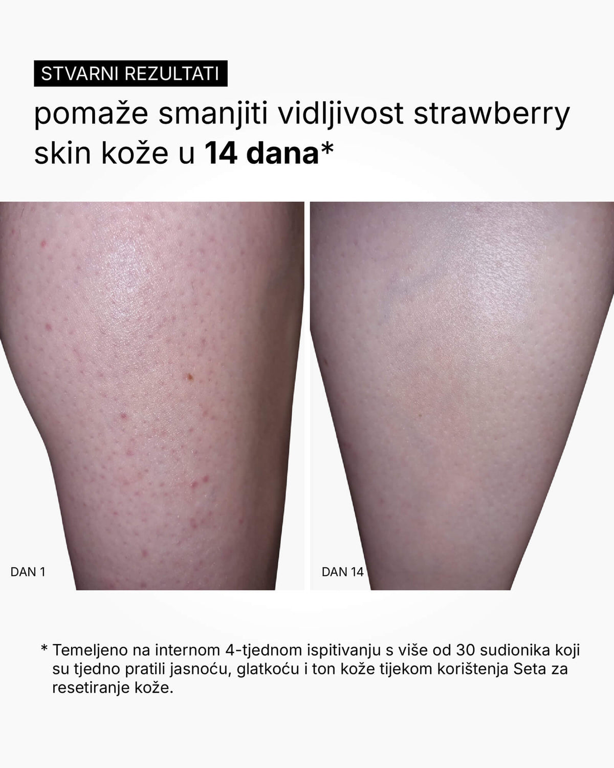 Set za resetiranje kože - rutina za cijelo tijelo